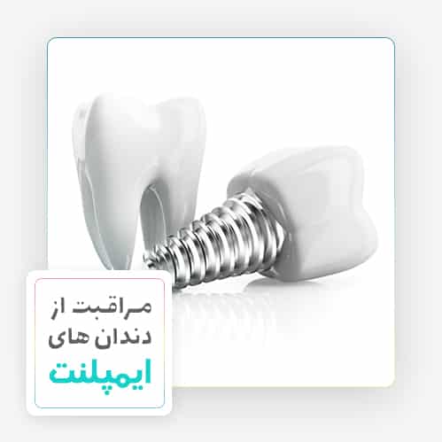مراقبت از دندان ایمپلنت - دکتر مهدی سمیعی